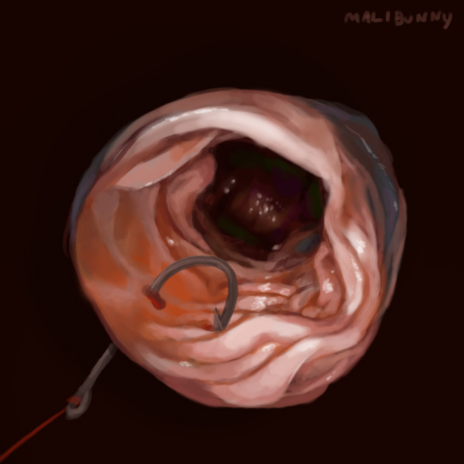 Digital painting of waht looks like a view inside someone's intestines, but just a cross-section with a fish hook attached to the end of it