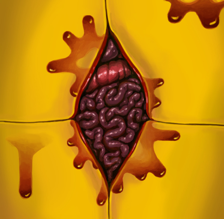 Digital drawing of a yellow background with a slit in it showing intestines under the 'skin'